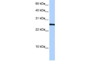WB Suggested Anti-CIRBP Antibody Titration:  0. (CIRBP 抗体  (N-Term))