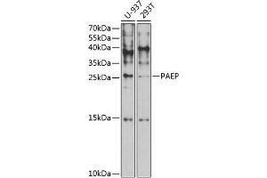 Western Blotting (WB) image for anti-Progestagen-Associated Endometrial Protein (PAEP) (AA 19-180) antibody (ABIN6145168)