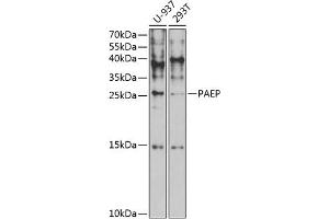Western blot analysis of extracts of various cell lines, using PAEP antibody (ABIN6130606, ABIN6145168, ABIN6145170 and ABIN6221423) at 1:1000 dilution. (PAEP 抗体  (AA 19-180))