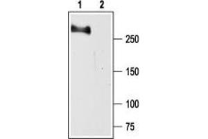 Western blot analysis of rat brain membranes: - 1. (SCN2A 抗体  (Intracellular))