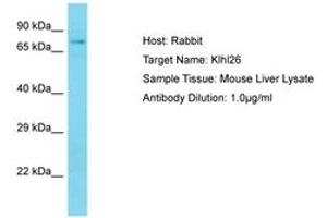 Image no. 1 for anti-Kelch-Like 26 (KLHL26) (AA 51-100) antibody (ABIN6750241) (KLHL26 抗体  (AA 51-100))