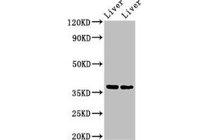 Western Blot Positive WB detected in: Mouse liver tissue, Rat liver tissue All lanes: CCNH antibody at 3 μg/mL Secondary Goat polyclonal to rabbit IgG at 1/50000 dilution Predicted band size: 38 kDa Observed band size: 38 kDa (Cyclin H 抗体  (AA 261-319))