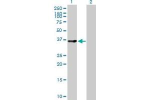 Western Blot analysis of LMOD1 expression in transfected 293T cell line by LMOD1 MaxPab polyclonal antibody. (Leiomodin 1 抗体  (AA 1-269))