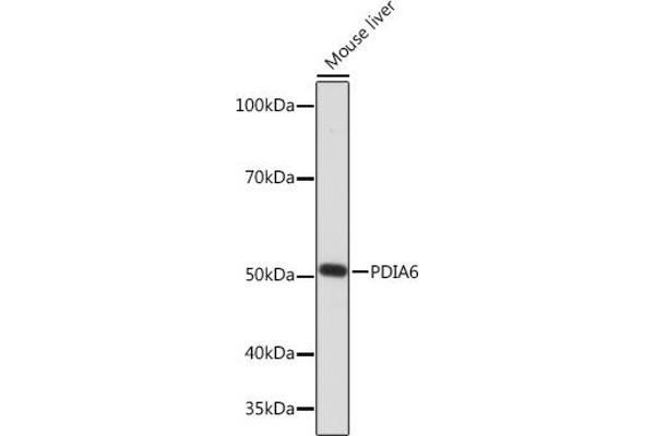 PDIA6 anticorps