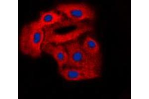 Immunofluorescent analysis of Arylsulfatase D staining in A549 cells. (Arylsulfatase D 抗体  (Center))