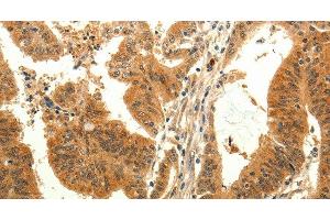 Immunohistochemistry (Paraffin-embedded Sections) (IHC (p)) image for anti-Transient Receptor Potential Cation Channel, Subfamily M, Member 7 (TRPM7) antibody (ABIN7238456)