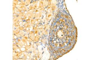 Immunohistochemistry (Paraffin-embedded Sections) (IHC (p)) image for anti-Protein Tyrosine Phosphatase G1 (PTPN12) antibody (ABIN7075292)