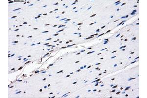 Immunohistochemical staining of paraffin-embedded endometrium tissue using anti-GBE1mouse monoclonal antibody. (GBE1 抗体)