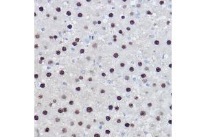 Immunohistochemistry of paraffin-embedded rat liver using EZH2/KMT6 Rabbit pAb (ABIN6133511, ABIN6140395, ABIN6140399 and ABIN6221414) at dilution of 1:100 (40x lens). (EZH2 抗体  (AA 1-250))
