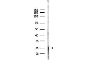 anti-PROP Paired-Like Homeobox 1 (PROP1) (Internal Region) antibody