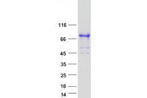 Validation with Western Blot