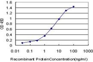 Detection limit for recombinant GST tagged CPS1 is approximately 0. (CPS1 抗体  (AA 1400-1500))