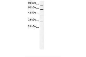 Image no. 1 for anti-Staphylococcal Nuclease Domain Containing Protein 1 (SND1) (AA 213-262) antibody (ABIN202943) (SND1 抗体  (AA 213-262))