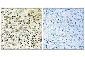 Immunohistochemistry (IHC) image for anti-CTD (Carboxy-terminal Domain, RNA Polymerase II, Polypeptide A) Small Phosphatase 1 (CTDSP1) (N-Term) antibody (ABIN1851030) (CTDSP1 抗体  (N-Term))