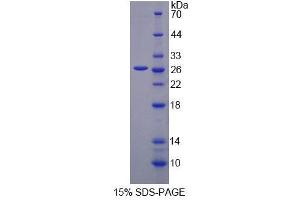 SDS-PAGE analysis of Human VARS Protein. (VARS 蛋白)