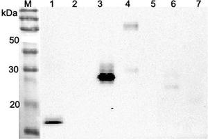 Western blot analysis using anti-ANGPTL4 (CCD) (human), pAb  at 1:2'000 dilution.