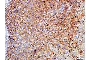 Formalin-fixed and paraffin embedded human endometrium labeled with Anti-FSH/FSHB Polyclonal Antibody, Unconjugated  at 1:200 followed by conjugation to the secondary antibody and DAB staining (FSHB 抗体  (AA 61-98))