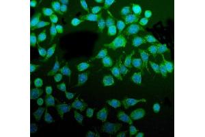 IF analysis of PDIA5 using anti-PDIA5 antibody (ABIN7601801).
