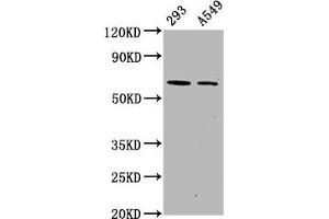Western Blot Positive WB detected in 293 whole cell lysate 65549 whole cell lysate All lanes Phospho-PRKAA2 antibody at 1. (Recombinant PRKAA2 抗体  (pSer491))