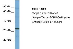 Host: Rabbit Target Name: C12ORF49 Sample Tissue: Human ACHN Whole Cell Antibody Dilution: 1ug/ml (C12orf49 抗体  (N-Term))