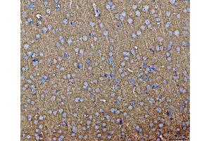 IHC analysis of Septin 3/SEPTIN3 using anti-Septin 3/SEPTIN3 antibody (ABIN7599288).