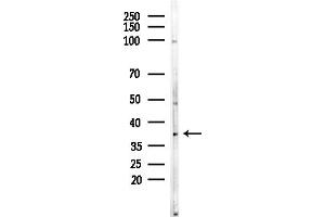 Western blot analysis of lysates from EC304 cells, using OR4 Antibody at 1/1000 dilution.