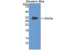 Detection of Recombinant Pax, Human using Polyclonal Antibody to Paxillin (PXN) (Paxillin 抗体  (AA 201-461))