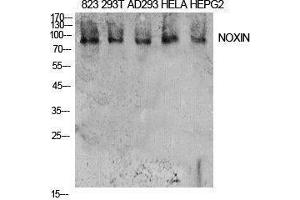 Western Blotting (WB) image for anti-Chromosome 11 Open Reading Frame 82 (C11orf82) (Internal Region) antibody (ABIN3181418) (C11orf82 抗体  (Internal Region))