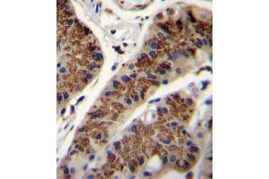 INHBA Antibody (N-term) (ABIN655078 and ABIN2844710) immunohistochemistry analysis in formalin fixed and paraffin embedded human stomach tissue followed by peroxidase conjugation of the secondary antibody and DAB staining. (INHBA 抗体  (N-Term))