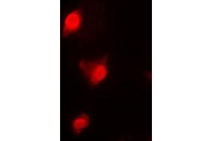Immunofluorescent analysis of Cyclin B1 staining in K562 cells. (Cyclin B1 抗体  (Center))