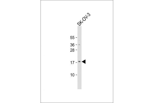 LYPD1 抗体  (C-Term)
