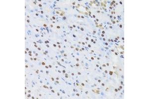 Immunohistochemistry of paraffin-embedded rat kidney using SFN Antibody. (14-3-3 sigma/SFN 抗体  (AA 1-248))