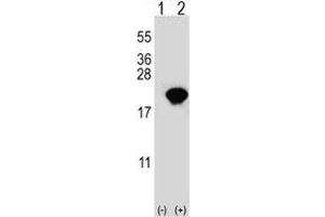 Western blot analysis of PIN1 antibody and 293 cell lysate either nontransfected (Lane 1) or transiently transfected (2) with the PIN1 gene. (PIN1 抗体  (AA 30-56))