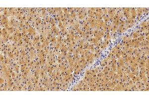 Detection of GHR in Human Liver Tissue using Polyclonal Antibody to Growth Hormone Receptor (GHR) (Growth Hormone Receptor 抗体  (AA 315-574))