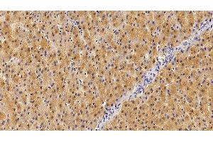 Detection of GHR in Human Liver Tissue using Polyclonal Antibody to Growth Hormone Receptor (GHR) (Growth Hormone Receptor 抗体  (AA 315-574))