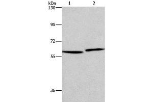 Western Blot analysis of Human testis and prostate tissue using HAS1 Polyclonal Antibody at dilution of 1:350 (HAS1 抗体)