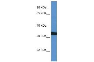 Western Blot showing GFRA4 antibody used at a concentration of 1 ug/ml against 721_B Cell Lysate (GFRA4 抗体  (C-Term))