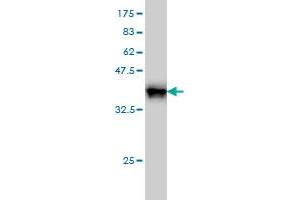 Western Blot detection against Immunogen (37. (GRF2 抗体  (AA 1-110))