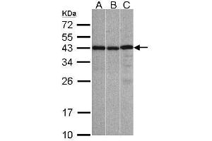 WB Image Sample(30 ug whole cell lysate) A:A431, B:Hep G2 , C:Raji , 12% SDS PAGE antibody diluted at 1:1000 (ZC3H8 抗体)