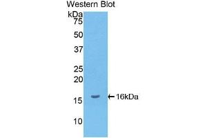 Western blot analysis of the recombinant protein. (CXCL9 抗体  (AA 23-125))