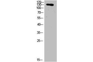 Western Blot analysis of HELA cells using primary antibody diluted at 1:2000(4 °C overnight). (COL19A1 抗体  (AA 161-210))