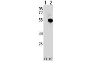 Western blot analysis of IRF4 antibody and 293 cell lysate (2 ug/lane) either nontransfected (Lane 1) or transiently transfected (2) with the IRF4 gene. (IRF4 抗体  (AA 164-191))