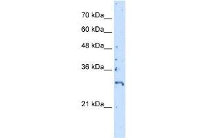 WB Suggested Anti-CREBZF Antibody Titration:  5. (CREBZF 抗体  (C-Term))