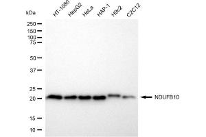 Western blotting analysis using NDUFB10 antibody (ABIN7799546). (NDUFB10 抗体)
