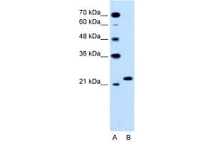 WB Suggested Anti-RAB14  Antibody Titration: 0. (RAB14 抗体  (C-Term))