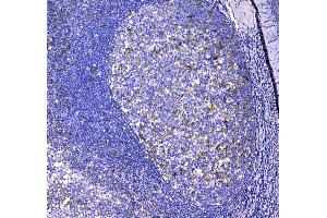 Immunohistochemistry (IHC) image for anti-Integrin, alpha X (Complement Component 3 Receptor 4 Subunit) (ITGAX) (AA 161-342) antibody (ABIN5693169)