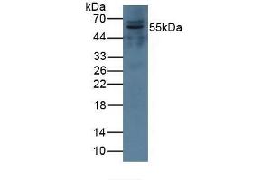 Detection of CFI in Porcine Kidney Tissue using Polyclonal Antibody to Complement Factor I (CFI) (Complement Factor I 抗体  (AA 28-243))