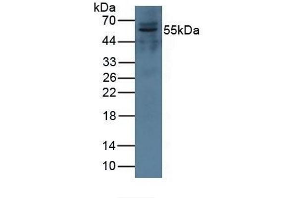 Complement Factor I 抗体  (AA 28-243)