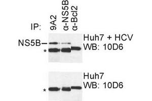 IP was carried out with NS5B specific mAb 9A2 using the lysates of Huh7 cells harboring selectable subgenomic HCV RNA replicon (upper panel) or plain Huh7 cells (lower panel). (HCV 1b NS5B 抗体  (AA 111-130))