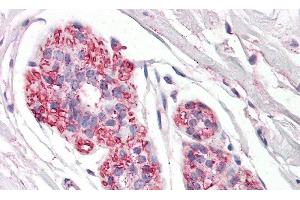 Detection of PDPN in Human Breast Tissue using Polyclonal Antibody to Podoplanin (PDPN) (Podoplanin 抗体  (AA 23-143))